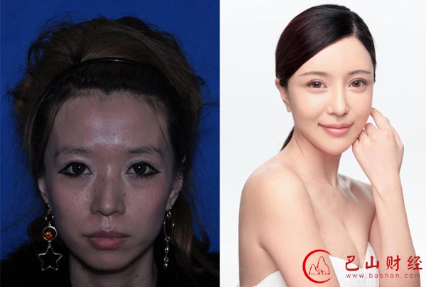 女子,整容,对比照