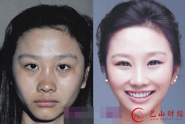 女子,整容,对比照