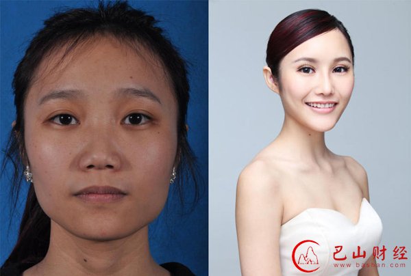 女子,整容,对比照