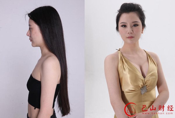 女子,整容,对比照