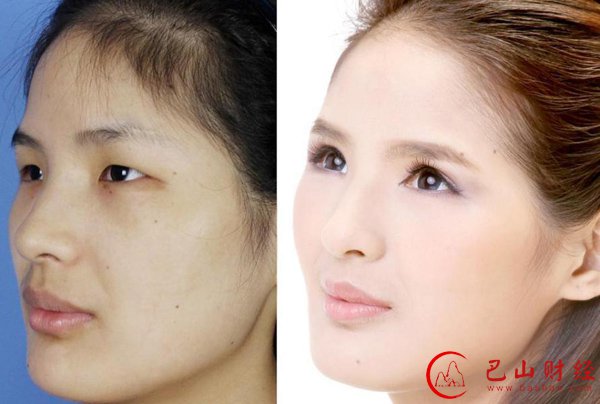 女子,整容,对比照