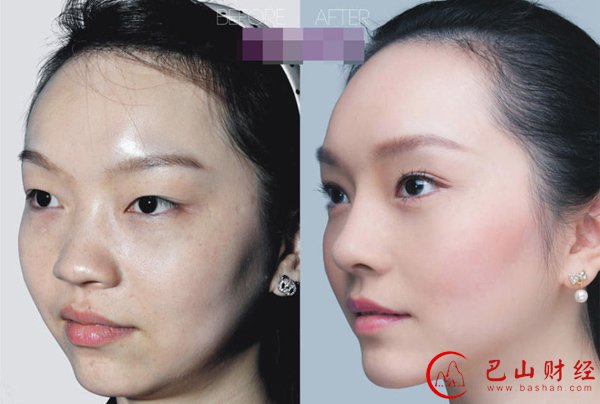 女子,整容,对比照