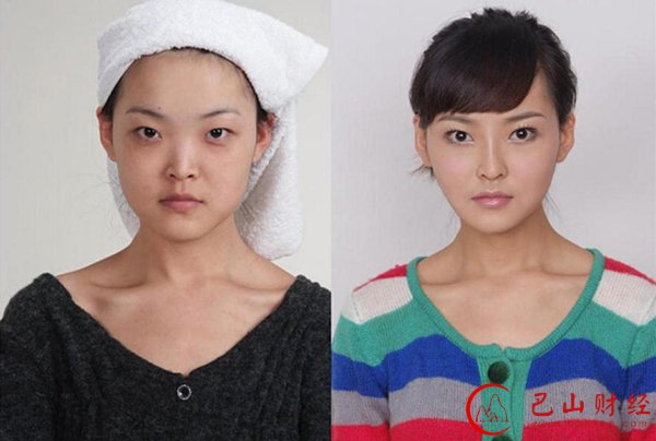 女子,整容,对比照