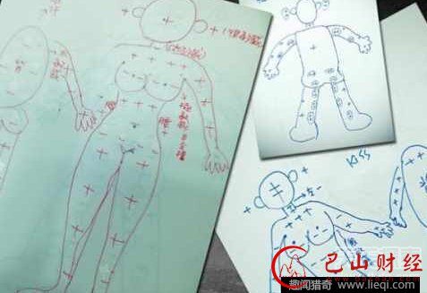 性治疗师真实工作亲自上阵指导(8)