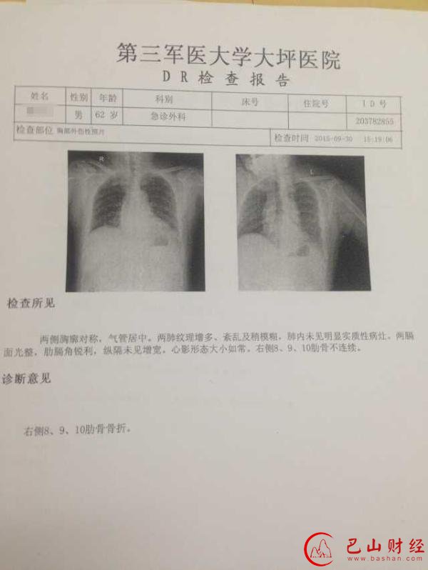重庆城管被指打断男子3根肋骨 街道办:桌椅撞的