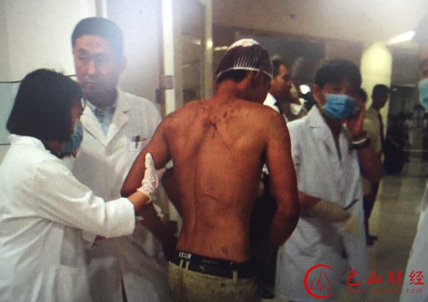爆炸,消防员,死亡,医院